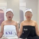 케이엠프라이빗 | 천안 신부관리 에스테틱 추천 케이엠에스테틱 민서쌤 후기