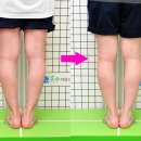 남자 오다리교정(O다리) 도수치료 무릎통증 교대역정형외과 강남수재활의학과 의원