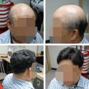 모위드헤어