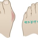 팔팔 두발로