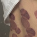 동양한의원 | 두나한의원 성수역 병원 직장인 통증 진료 후기