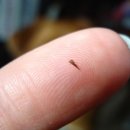 가시 살이 이미지