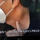 방사선 치료 종류별 비율 이미지