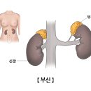 대송한의원 네이버블로그