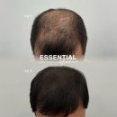 에센셜스튜디오 SMP 이미지