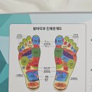 이숙경발가락교정구 무지외반증 교정기 밸런스풋 사용 후기