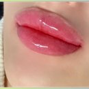 서구-54 | [목동 반영구 두피 점착 후기] M자 탈모? 감쪽같이 사라졌어요 리얼 내돈내산 후기 공개!
