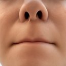 본한의원 | 만성 비염 치료 한의원 배농치료 받아본 후기