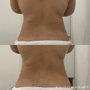 영통 에스테틱 바디관리 잘하는 &#34;에스테틱다리아 수원본점&#34;에서 EMS 복부 테라피 후기