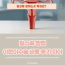질수축 방법 이쁜이수술 비용 후기 차이, 잘하는곳 특징은?