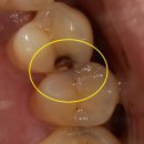 퍼스트치과기공소 이미지