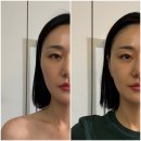 미소스킨케어 - 전주시 완산구 | [대구/수성구 ] 웨딩관리 추천, 미소스킨앤바디 윤곽관리 후기후기