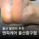 제이에스힐링의원 | 울산발각질 굳은살 제거 우정동 엔피케어 울산중구점 패디플래닝 후기
