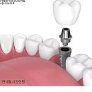 연세갤러리치과의원 이미지