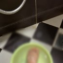 부평힘찬 | 부평힘찬병원 I 제5중족골 피로골절 비수술 후기 (feat. 발등골절 꿀템/꿀팁 대방출)