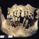 상아치과재료 이미지