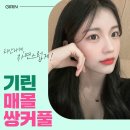 도화눈 | 쌍수 후기 사진(+눈매교정/앞트임/애교필러)