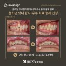 글로벌아너스
