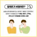 마른기침의 원인과 예방