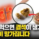 이런 음식을 드시면 신장에 돌을 만들고 콩팥이 망가집니다(신장, 요로 결석에 좋은 음식과 나쁜 음식 그리고 예방하는 영양제) 이미지