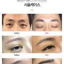 케이스성형외과의원 이미지