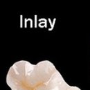 바로나치과기공소 이미지