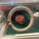 포포 데이케어 | [출산일기] 41주 0일 초산모 유도 실패 제왕 엔딩...! 4kg 아기 탄생