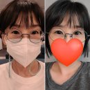 40대 라섹수술후기 통증회복과정 두꺼운 안경렌즈빠이 새로운 세상 (ft.노안살짝ㅠ)