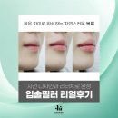 Dr 목의원 | 입술필러의 핵심은 디자인과 리터치, 압구정 피부과 이유클리닉 실제 진행사례와 후기