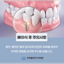 양플란트치과의원 이미지