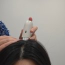 울산 두피케어 모안 남구청 근처 두피진단 후 케어