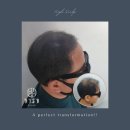 하이스칼프 이미지