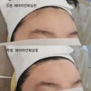 헤어송(HAIR SONG) - 북구 | [청주 용암동헤어라인 왁싱] 답답하고 좁은 이마, 왁싱 하나로 1.5배 넓어 보이는 비결! (feat. 매끈한...