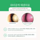 서초소망한의원 | 축농증 수술 미뤄뒀다간 어떤 일이 발생할지도 몰라요