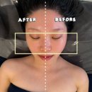 마린시티1로 | 부산 마린시티 피부관리 입체윤곽관리 후기 얼굴라인 정리 효과