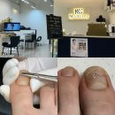 범계역 네일 엠빌리지네일 내성발톱 교정 솔직 후기