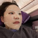 이어담한의원 | 대구 여드름 피부과 한의원 | 약초침 한달차 리얼후기