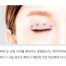 티나성형외과의원 이미지