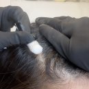 1299 | [방문후기] 청담 차홍 헤어클리닉 추천｜두피진단+앰플+스팀케어 루트스톤케어 후기