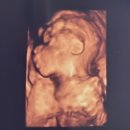 연세킹의원 | [임신일기.11]임신 22주 입체초음파, 임신 중기 복통으로 병원간 후기