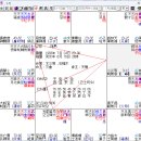 뇌경색 이미지