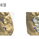 베스트치과기공소 이미지
