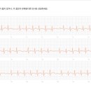 나는 왜 재발했을까? 나의 안좋은 성격ㅎㅎ 이미지