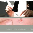 예스피부과의원 이미지