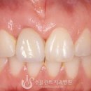 수플란트 이미지