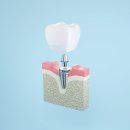 행복플란트치과의원 이미지