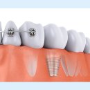 유디수원치과의원 이미지