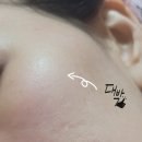 |아누아 피디알엔 히알루론산 캡슐 100 세럼| #화해꼼평단 #리얼후기 #건성세 #속건조세럼
