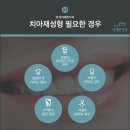 재성철물