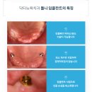 보강치과기공소 이미지